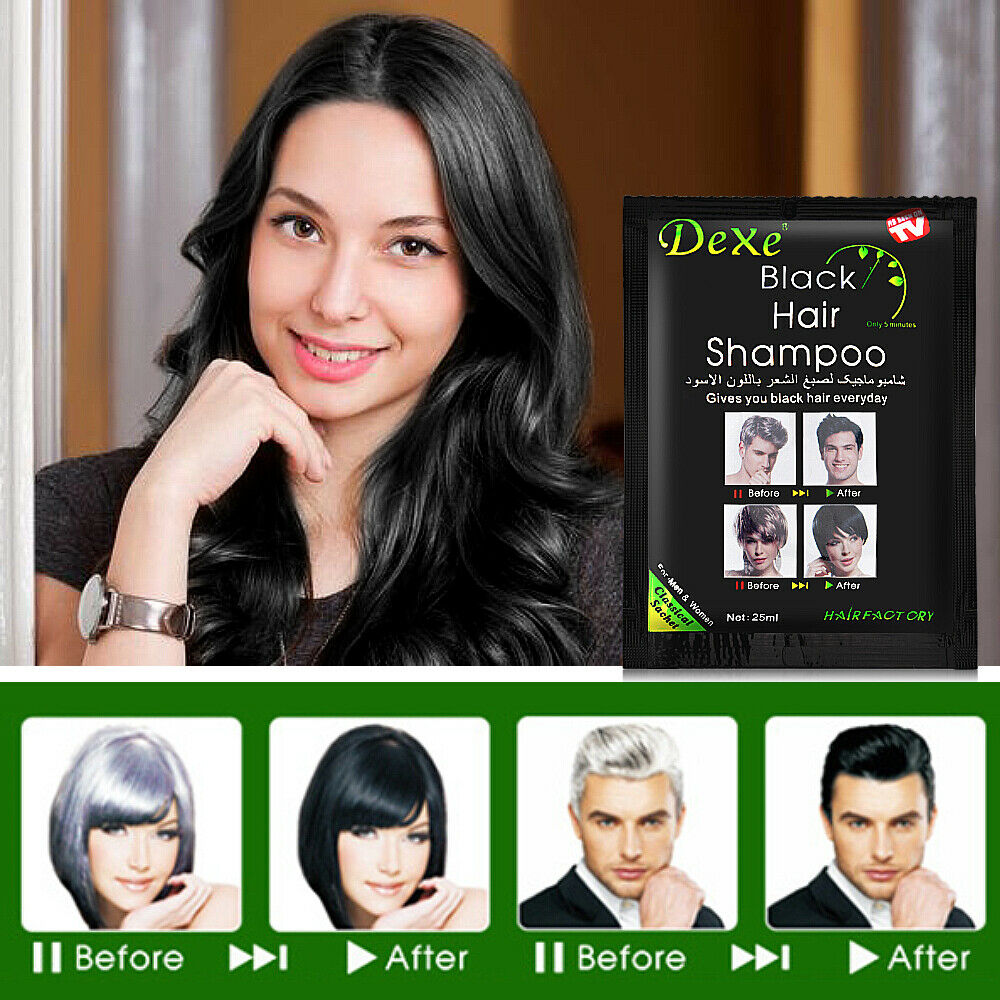 SHAMPOO ANTICANAS DEXE